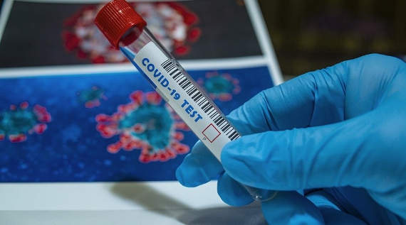 пробирка тест на коронавирус
