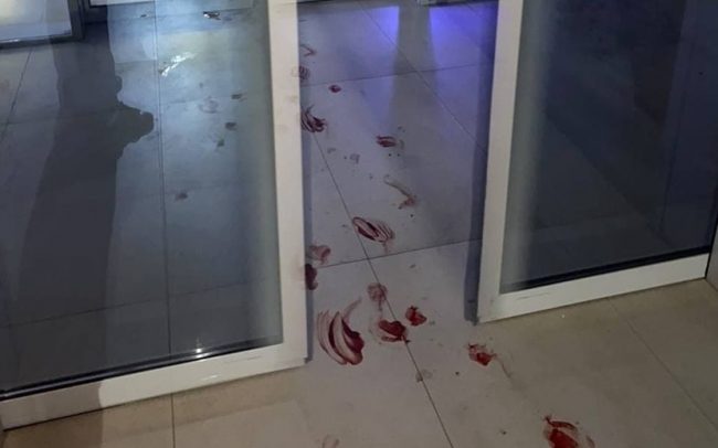 драка, которая произошла в севастопольском спа-комплексе «Акваделюкс», а также фотографии окровавленного пола