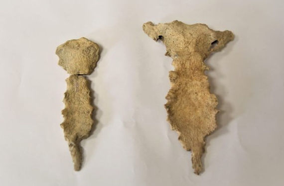Во время раскопок в Херсонесе антропологи обнаружили грудные кости двух мужчин, один из которых мог болеть фибродисплазией