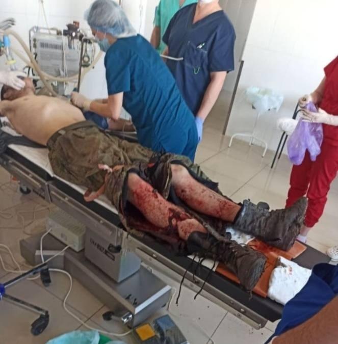 Украинские врачи оказывают помощь сдавшемуся в плен солдату армии РФ. Мужчина получил ранение ног