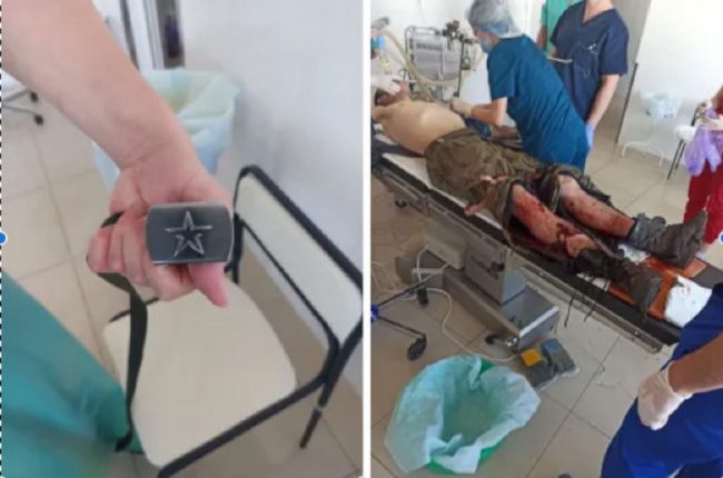 Украинские врачи спасают российского солдата, который сдался в плен